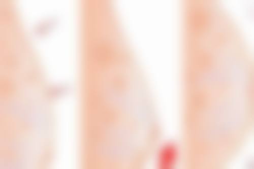 湖北鄂州轻青美医疗美容电话号码