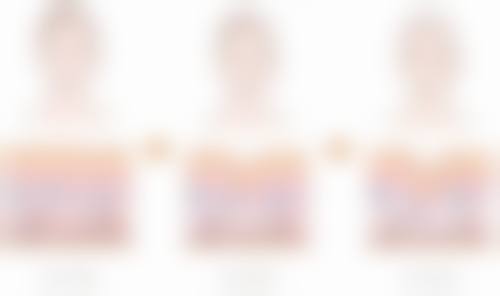 神户Luminous诊所真实实例：见证美丽蜕变