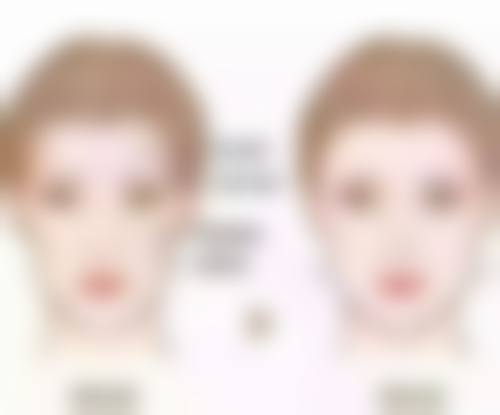 ZZ口腔医美综合医院的按摩去眼袋值不值