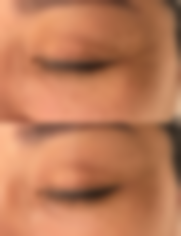 深圳鹏辉医疗美容门诊部真实实例