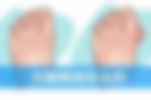 庞艳医生擅长项目