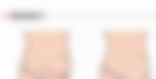 假体取出后做假体隆胸开启美丽新可能值不值