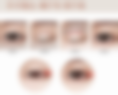 假体取出后做假体隆胸的修复周期靠谱吗