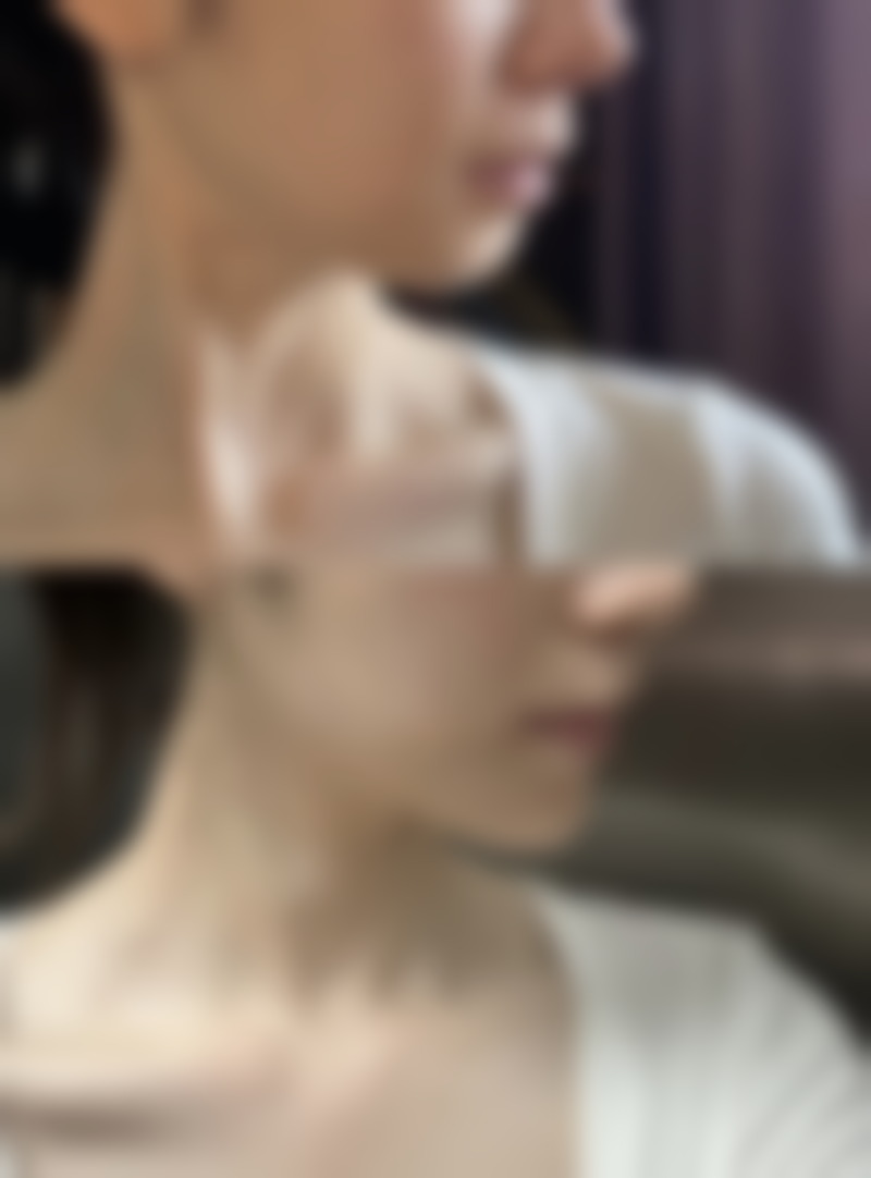 王学亚医生真实实例