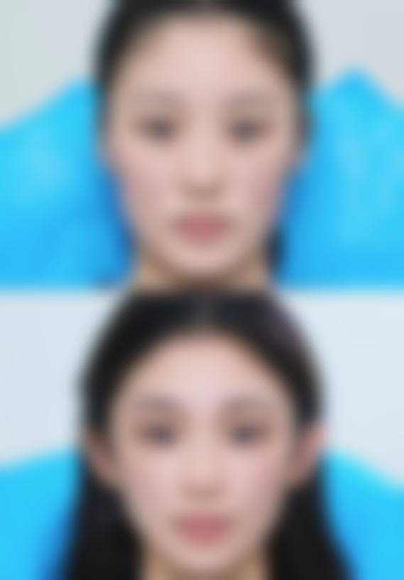 湖北省王文医生擅长的医美项目适合哪些人？