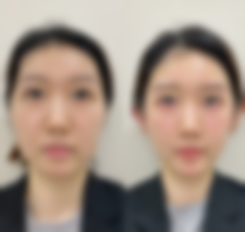 达州甄美医疗美容诊所仪器设备