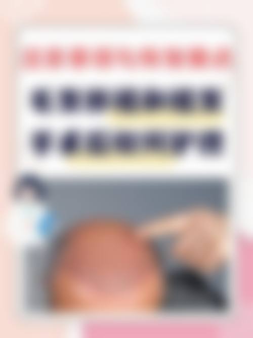 厦门大麦植发医院营业时间：方便你的安排