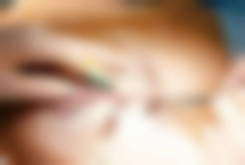 隆鼻后泡温泉需要注意什么