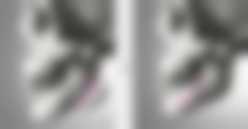 倪铭医生在放射科的看诊优势