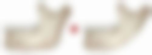 熊锦医生技术特点