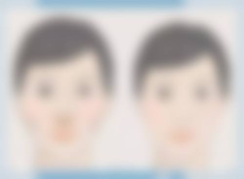 倪铭医师的技术特点大揭秘