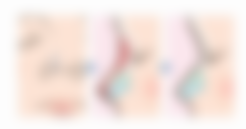 避免抓挠疤痕对缓解烧伤疤痕发痒靠谱吗