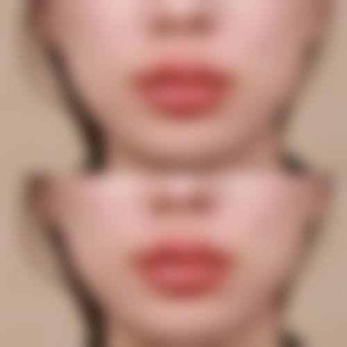 北京柳圣贤整形美容外科口碑怎么样