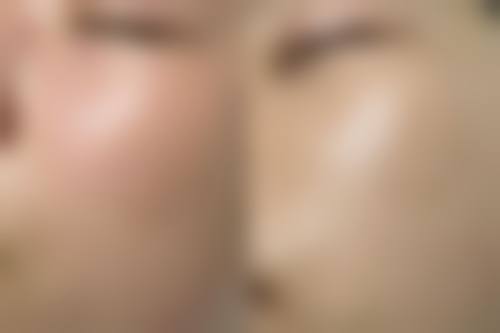 陕西汉中谭医生整形美容真实实例