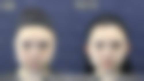 大连瑞丽植发医院真实实例：见证成效，树立信心