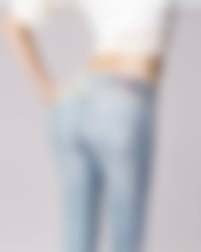 邯郸华希医疗美容门诊部真实实例：见证美丽奇迹