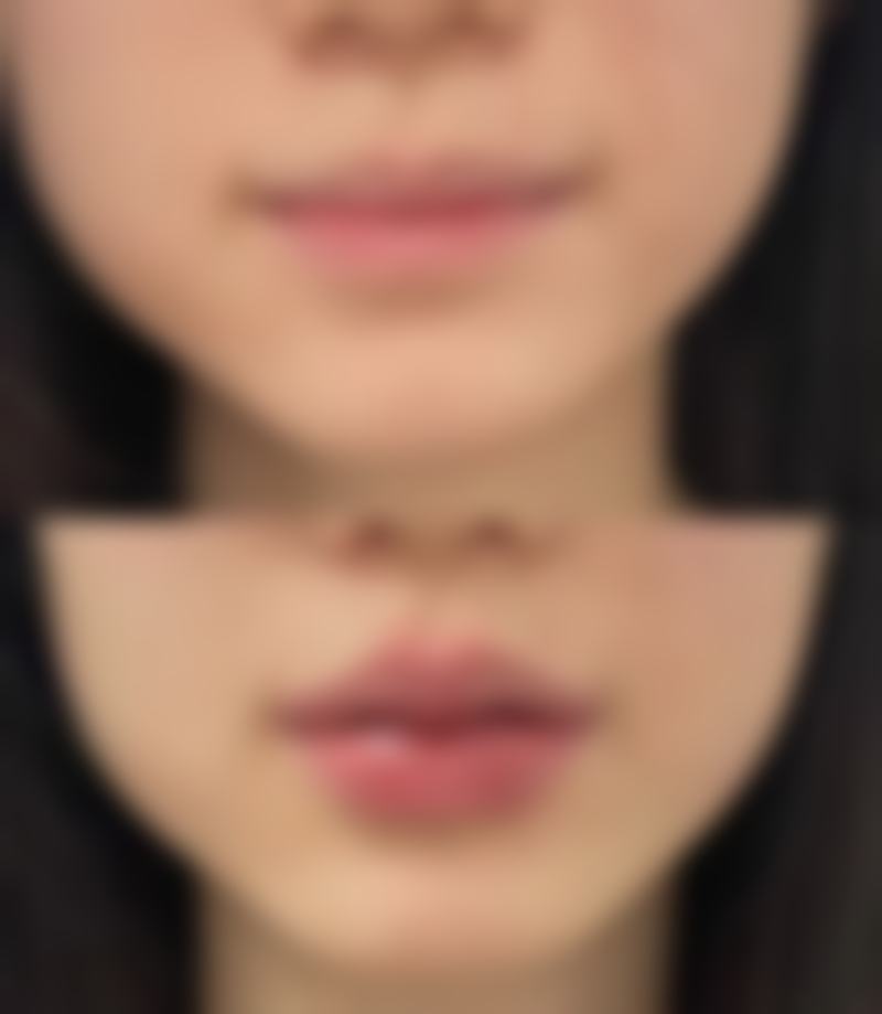 熊锦医生口碑评价