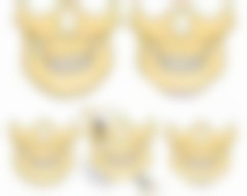 自体耳软骨隆鼻3 - 6个月完全修复适合所有人吗