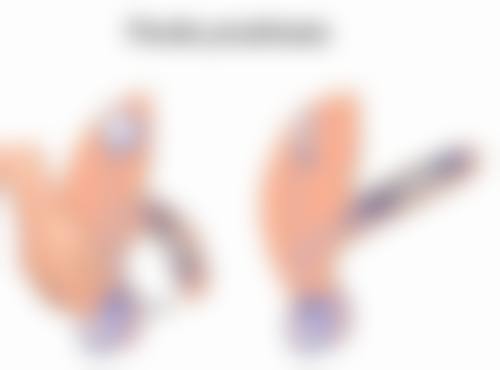 自体耳软骨隆鼻值不值等这么久修复