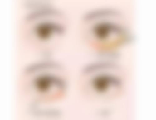 朱少栋医生怎么预约挂号：超便捷的预约方式