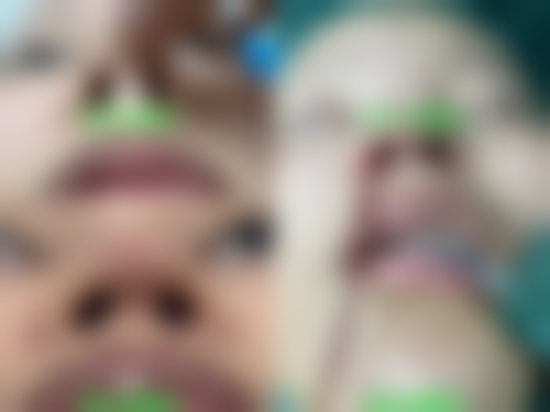 长春素人医疗美容诊所预约挂号方式