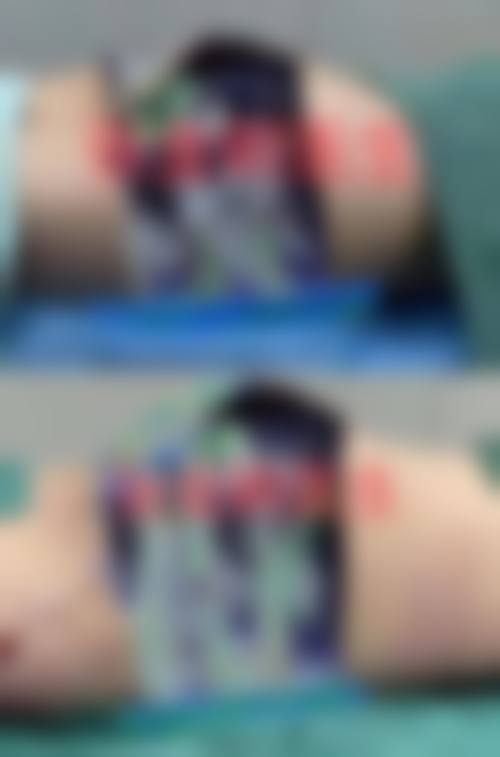 上海佳仁汇医疗美容门诊部价格表