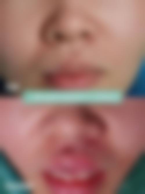 常州市第二人民医院（整形美容科）口碑怎么样