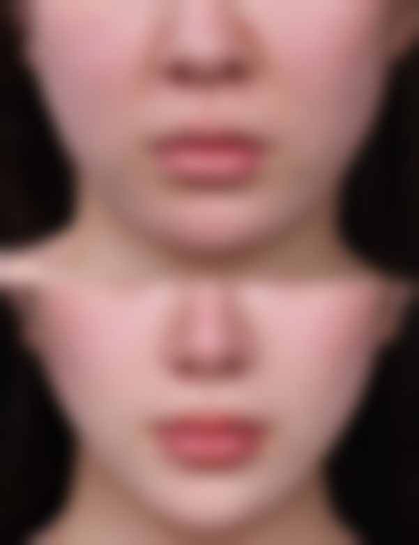 赣州妃整形医院电话号码