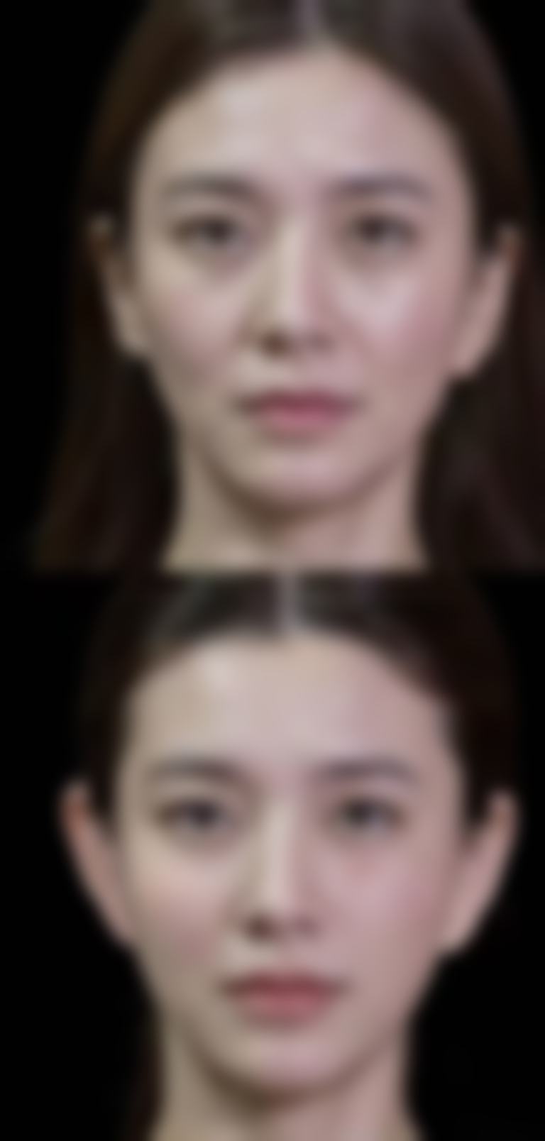 长春素人医疗美容诊所价格表