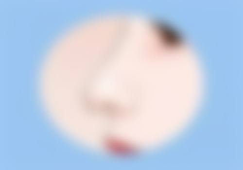 侧切疤痕增生用激光治疗值不值