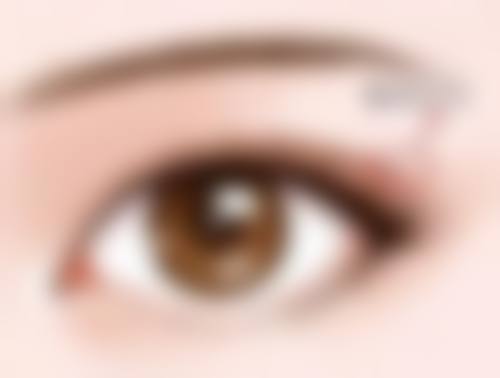 抽脂富贵包导致感染的危害大吗？