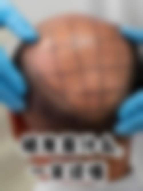 郑州星范医疗美容医院擅长项目