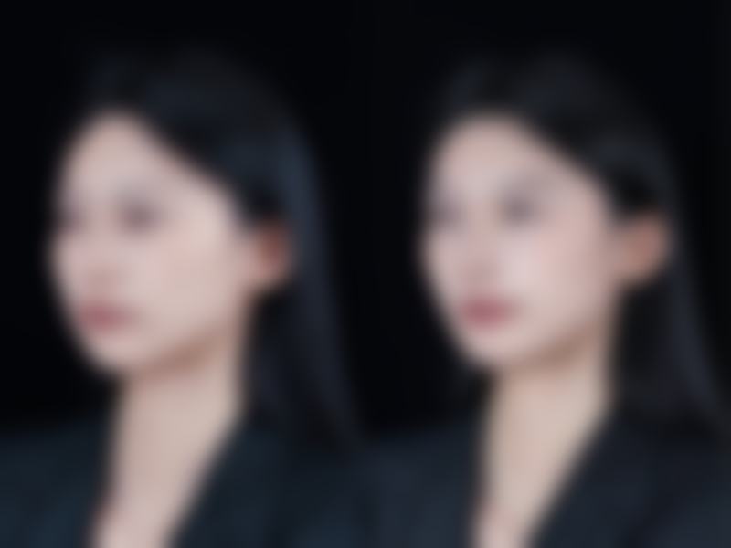 韩国维摩整形外科