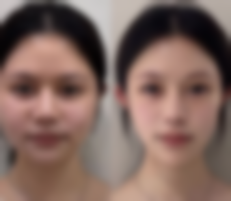 滁州市中医和西医结合医院皮肤科真实实例