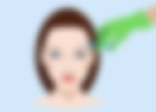 肚子抽脂后会出现感觉减退吗？