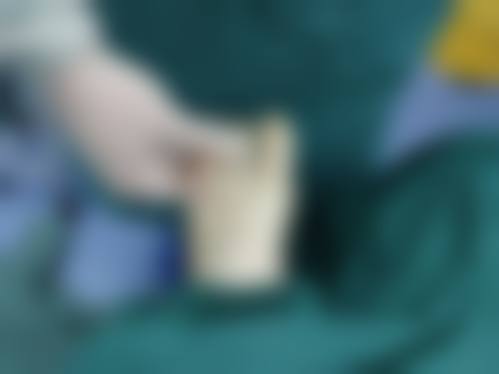 西安玛莲伦娜整形医院真实实例