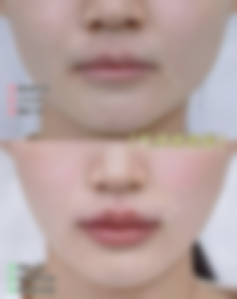 罗文娟医生的口碑评价怎么样