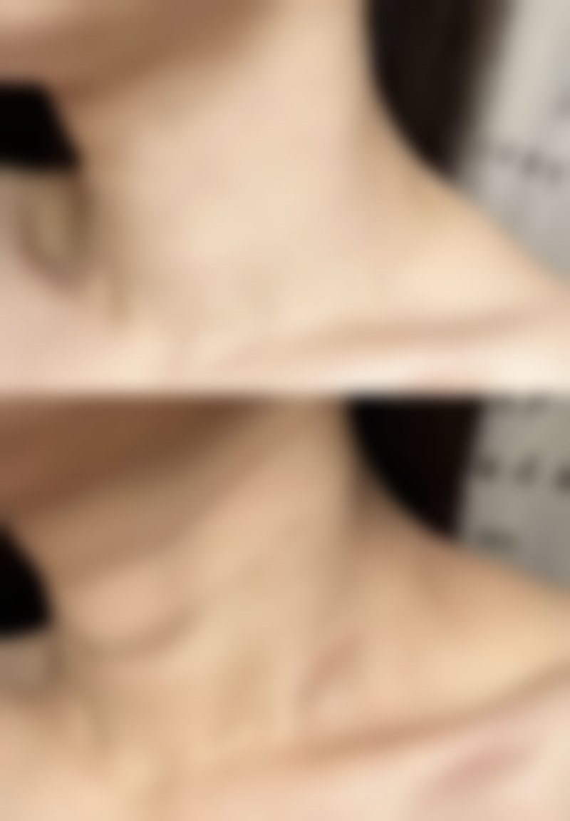 佛山颜植加医疗美容诊所价格表