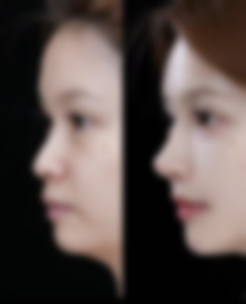 焦作莱美医疗美容诊所擅长项目