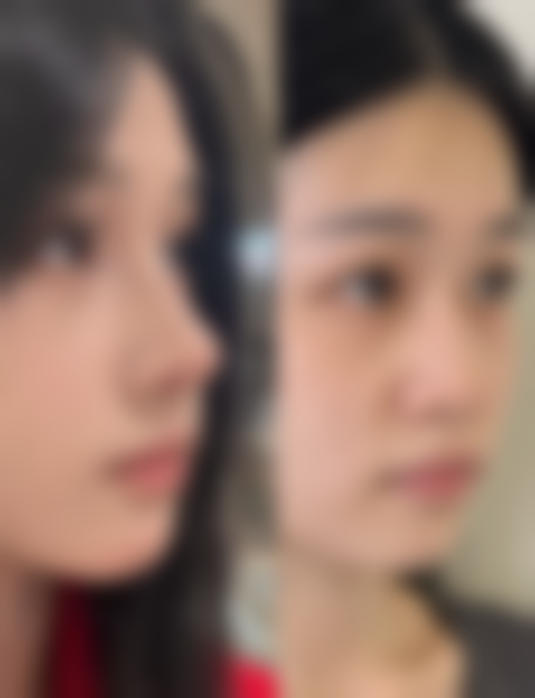 武汉斯启诺医疗美容门诊部董雷医生预约需注意什么