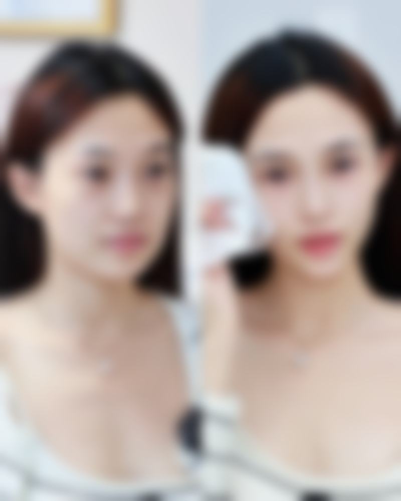 武汉斯启诺医疗美容门诊部董雷医生预约怎么样进行后续跟进