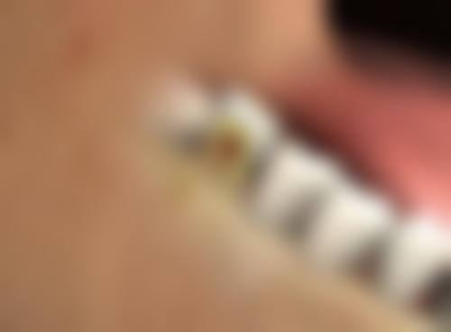 怎么选择适合睡眠中把眼睛睡成双眼皮的方法