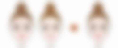 法国ES隆胸假体值不值