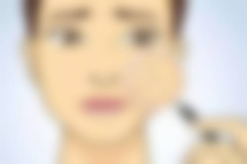 涂抹双眼皮胶水在睡眠中把眼睛睡成双眼皮适合吗