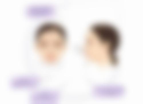 注射治疗增生性疤痕适合吗