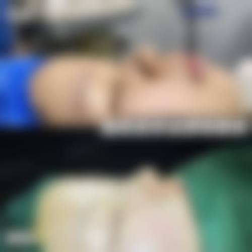 包头鸿宾极光医疗美容门诊部擅长项目