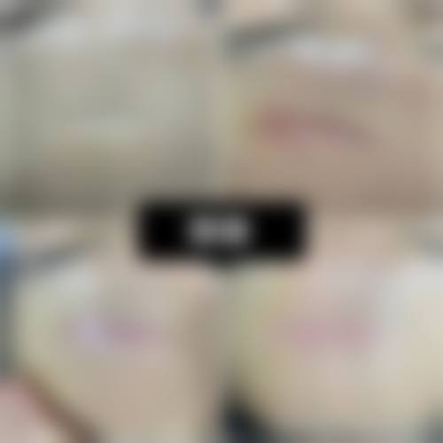 洛阳亚峰整形美容诊所口碑怎么样