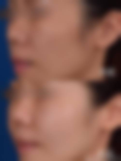 宜宾市第三人民医院整形美容科口碑怎么样