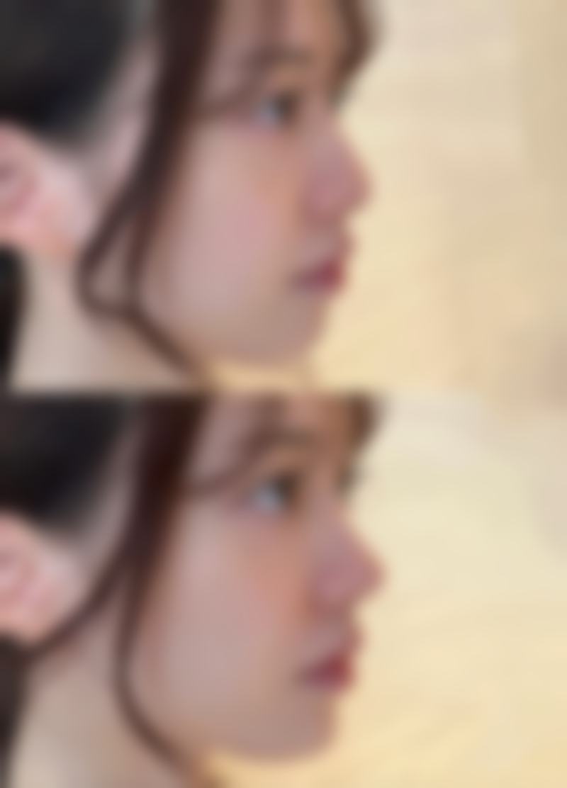 宜宾市第三人民医院整形美容科真实实例