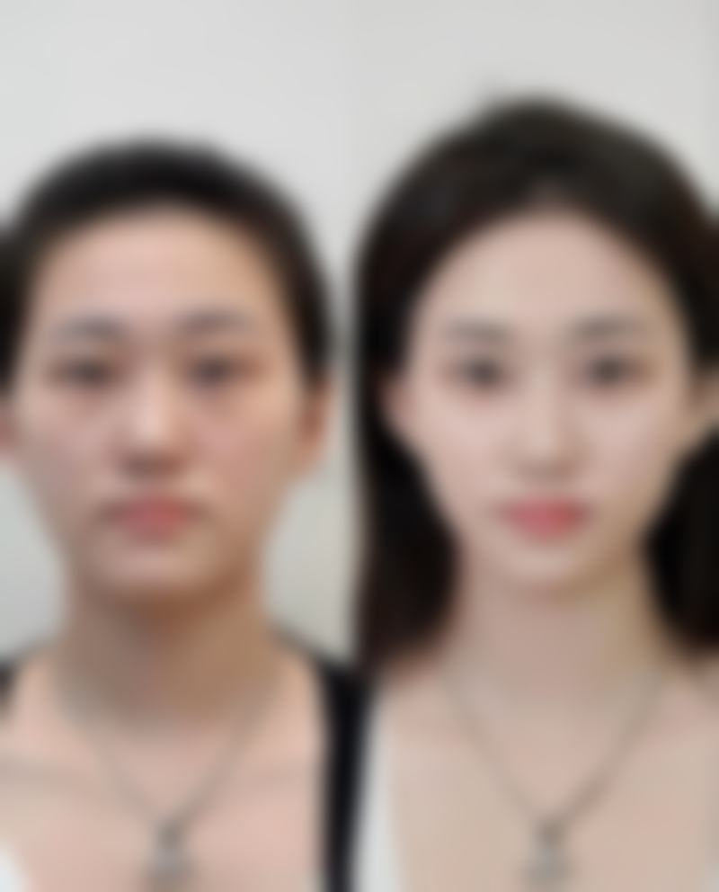 韩国AD爱慕整形外科医院口碑怎么样